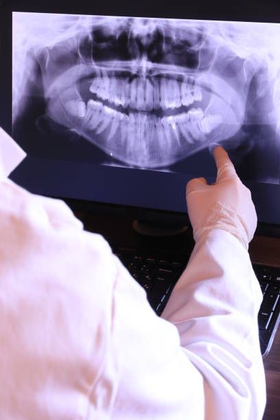 Best Emergency Denture Repair in Huron, CA